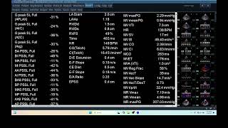 IQ 256 HEMODYNAMIC MEASUREMENT ECHOPAC ANALYSIS ECHOCARDIOGRAPHY REPORT [upl. by Ellene617]