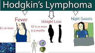 Hodgkins lymphoma Hodgkins disease  Symptoms and treatment How to detect lymphoma [upl. by Farmann]