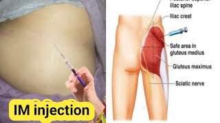 IM injection lgany ka Tareqa  Intramuscular injection site [upl. by Farron]