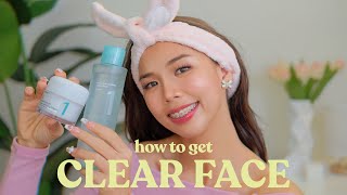 THE BEST SUMMER SKINCARE FOR OILY ACNEPRONE SKIN easy amp effective 💕😳 [upl. by Eeluj]