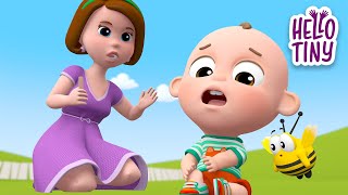 Ouch Ouch Song Boo Boo Song  Kids Songs and Nursery Rhymes  Hello Tiny [upl. by Rebmik]