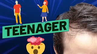 Hair Loss In Teenagers Top 8 Causes and How To Treat It [upl. by Clementine]