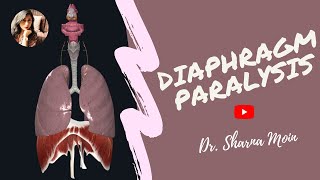 Diaphragm paralysis paradoxical breathing  injury to phrenic nerve [upl. by Lehacim]