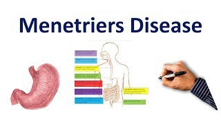 Menetriers Disease Made Easy USMLE Step 1 NCLEX COMLEX [upl. by Carlina]