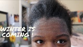 Dandruff EDGES Edition [upl. by Lubba]