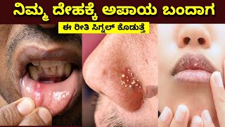 vitamin deficiency symptoms in Kannada [upl. by Ellehc]