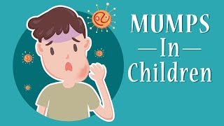 Mumps in Children  Signs Causes amp Treatment [upl. by Dust338]