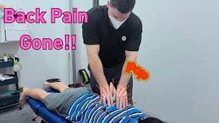 ASMR doctor Satisfying ASMR spinal crack  Asmr chiropractic adjustment crack Compilation [upl. by Daukas541]