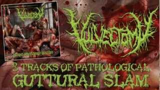 VULVECTOMY  Abusing Dismembered Beauties Album Teaser [upl. by Rocher]