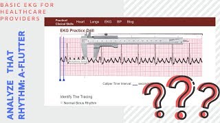 Analyze That EKG Rhythm Atrial Flutter AFlutter [upl. by Ailes]