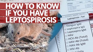 How to know if you have Leptospirosis Lifesaver [upl. by Chadabe]