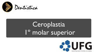 Ceroplastia 1º molar superior [upl. by Eliezer]