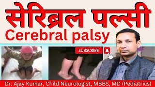 Cerebral Palsy  Dr Ajay Kumar Child Neurologist in Patna Call 7250023111 9546454005 [upl. by Nonnairb]