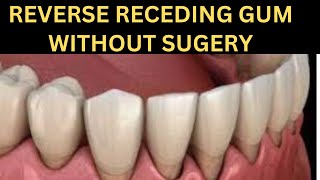 7 Best Ways For Receding Gum Treatment Naturally Without SurgeryCure Receding Gum [upl. by Chiles]