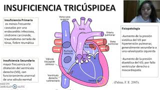 video 1 insuficiencia tricuspide NJ [upl. by Sokram]