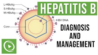 Hepatitis B Overview Clinical Presentation Diagnosis and Management  Lecturio [upl. by Dubois891]