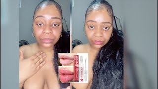 HOW TO GET THE MOST JUICY KISSABLE LIPS 👄 ALL IN 5 MINUTES  NO INJECTIONS [upl. by Ajnat]