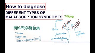 How to get to the most likely diagnosis Malabsorption Syndromes Celiac Whipple and more [upl. by Aya]