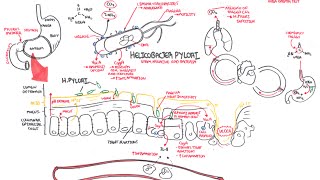 Microbiology  Helicobacter Pylori Ulcer [upl. by Mehalick96]