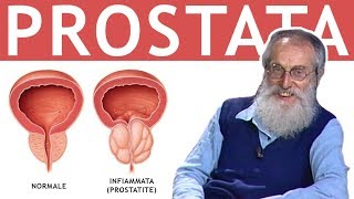 Dott Mozzi Prostata prostatite tumore adenoma problemi maschili [upl. by Sergu]