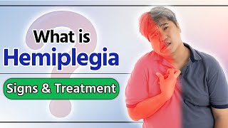 Hemiplegia  janiye kya hota hai hemiplegia  hemiplegia in hindi  hemiplegia treatment [upl. by Katzir]