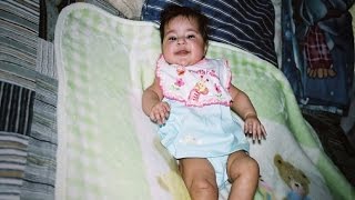 New Unique Surgery for Congenital Heart Disease Angelas Story [upl. by Enelear]