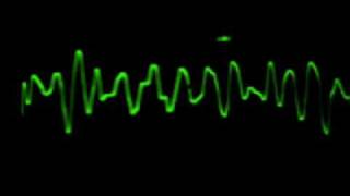 EKG Fibrilación Ventricular [upl. by Asoramla]