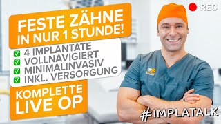 Komplette LIVEOP  Feste Zähne in nur 1 Stunde ❗  4 Zahnimplantate Minimalinvasiv gesetzt [upl. by Hester]