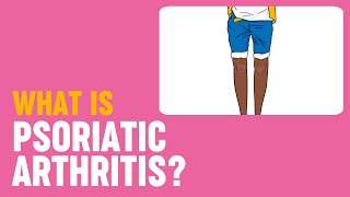 What is psoriatic arthritis [upl. by Harahs]