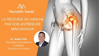 La prothèse de hanche par voie antérieure miniinvasive  Dr Majed Issa chirurgien orthopédiste [upl. by Bullen]