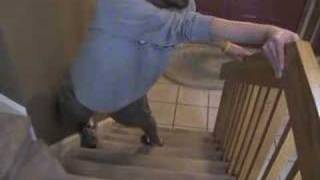 LimbGirdle Muscular Dystrophy 2A Stair Climbing Part 1 [upl. by Aissela351]