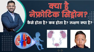 What Is Nephrotic Syndrome  नेफ्रोटिक सिंड्रोम क्या है  Dr Kunal Pai  Pediatric Nephrologist [upl. by Akerdal]