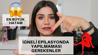 YAPTIĞIM EN BÜYÜK HATA 🤯 iğneli epilasyon yüz tüyleri ağda lazer [upl. by Aehsan906]