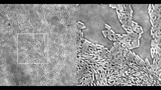 Pseudomonas twitching motilitythe closeup [upl. by Lurie148]