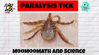 Ticks in AustraliaParalysis Tick [upl. by Janaya51]