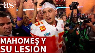 SUPER BOWL  MAHOMES consiguió el anillo LESIONADO  DIARIO AS [upl. by Nnylirehs724]