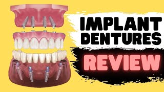 Implant Dentures vs Snap In Dentures vs All on 4 [upl. by Haras]