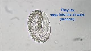 Dictyocaulus viviparus egg Bovine Lungworm quotHoosequot [upl. by Myo]