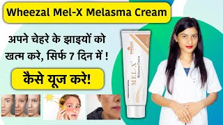 HIRUDAL CREAM\GET RELIEF TO YOUR BABY FROM VACCINE PAINREVIEW IN HINDI\ DONT WORRY [upl. by Nobe35]