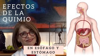 Efectos de la quimioterapia EN EL ESÓFAGO Y ESTÓMAGO Hematooncología [upl. by Lorollas284]