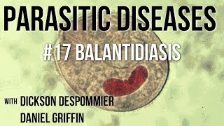 Parasitic Diseases Lectures 17 Balantidiasis [upl. by Braasch]