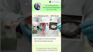 Diagnosis amp treatment of uterine fibroid doctor [upl. by Atsahs]