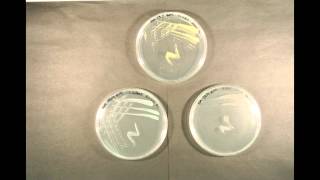 Bacterial Growth time lapse [upl. by Minor953]