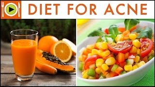 Best Foods for Acne Treatment  Healthy Recipes [upl. by Aimar]