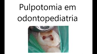 Pulpotomia em odontopediatria [upl. by Dunston803]