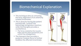 Mobilization to correct an Anterior Innominate rotation of the pelvis Physical Therapy [upl. by Cullie]