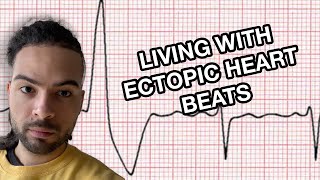 5 Tips for Living with Anxiety and Ectopic Heart Beats [upl. by Clercq]