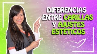 Diferencia entre Carillas Dentales y Bordes Incisales l Ajustes Estéticos [upl. by Arjan]