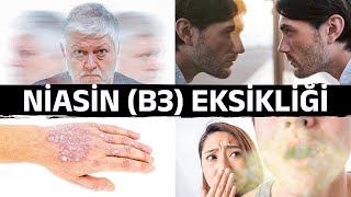 Niasin B3 Eksikliğinin Şaşırtıcı Belirtileri  Dr Berg Türkçe [upl. by Aznerol775]