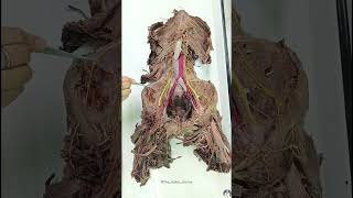 Lumbar plexus anatomy mbbs top viral brdmedicalcollege doctor medico trending mbbsmd aiims [upl. by Annaihs]